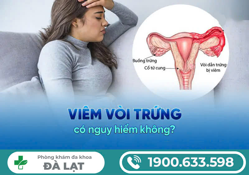 Viêm vòi trứng có nguy hiểm không? Tìm hiểu và điều trị tại Phòng khám Đa khoa Đà Lạt
